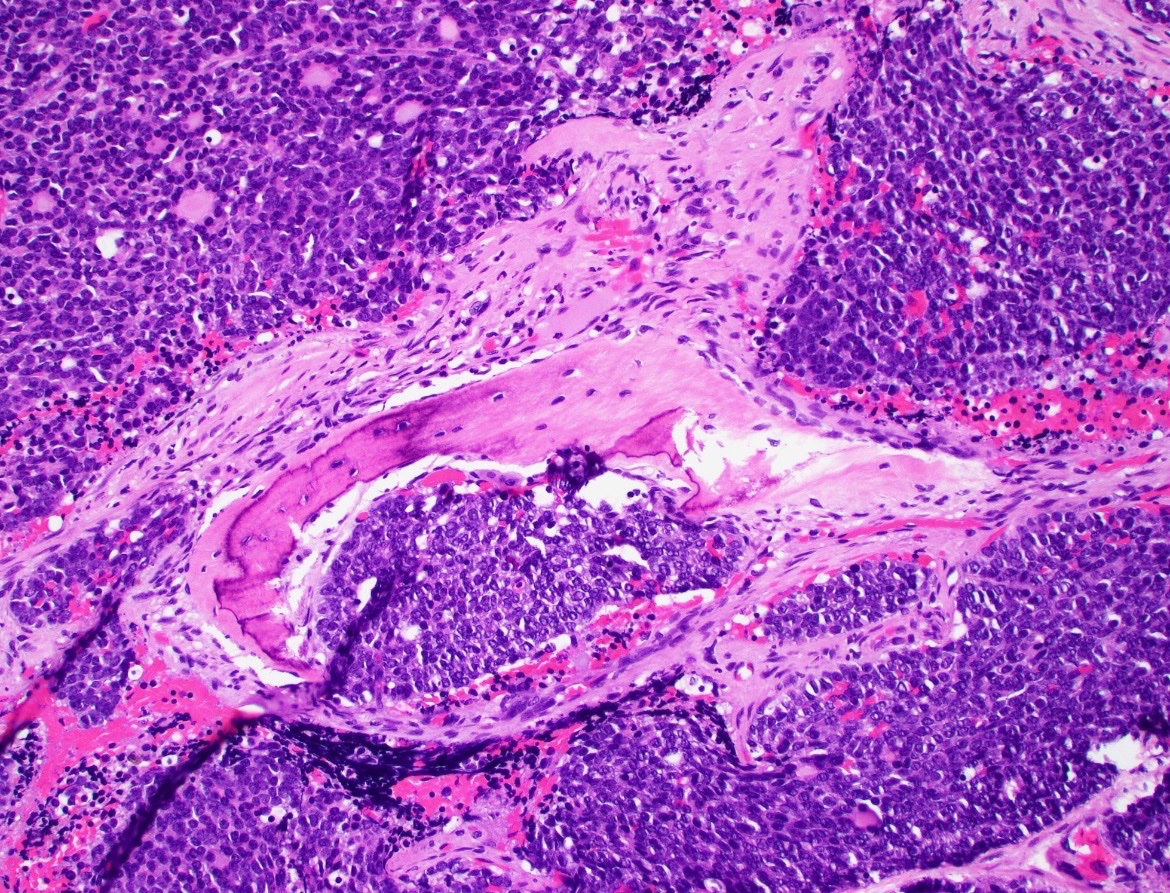 ENTpathology tweet picture