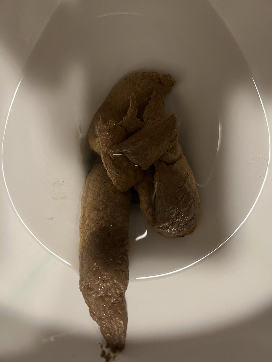 luke2joseph1's tweet photo. Poop Update
*I didn’t feel any urges to Poo, yesterday. https://t.co/mzhTpQ6ef6