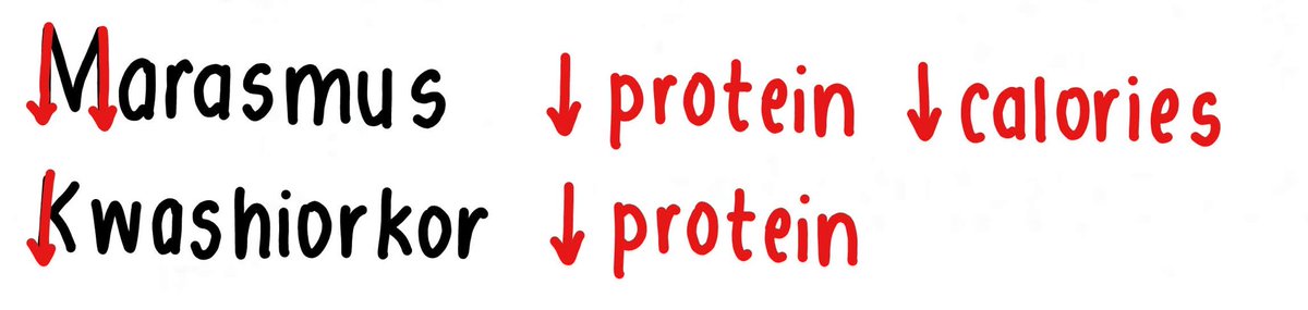 riebisco's tweet photo. how i remember Marasmus vs. Kwashiorkor.

Marasmus → dalawang vertical lines sa M = both protein and calories are ↓ ↓ 

Kwashiorkor → isang vertical lang sa K = only protein in ↓ https://t.co/dpjrz3PDX3