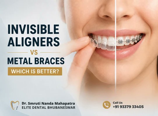 elitedentalbbsr's tweet photo. Choosing between #invisiblealigners and #metalbraces can be confusing.
Which option could fit your smile and daily routine better?
See the key differences and what to consider before choosing

🌐https://t.co/7JllvDqAKA

#Braces #DentalCare #DentalTips #HealthyTeeth #Bhubaneswar https://t.co/oryQsK1i3E