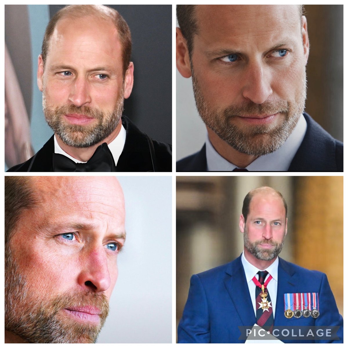 AllexmarieHoll1's tweet photo. It never ceases to amaze me how a mother can govern birth to two very very different children. 

One, her soulmate (her words) and eldest son, William. A kind, caring, wise, handsome man. A wonderful husband and father to three gorgeous children. A statesman. A future King who is genuinely loved, respected and valued the world over. I give you HRH The Prince of Wales. 

And then ….

Harry - the absolute complete opposite of his gorgeous brother and not just in looks. He isn’t even liked in most corners of the world. Certainly not respected and valued (unless of course you’re one of those notright anal groupies of his and the current wife). 

Thank heavens William was the first born.