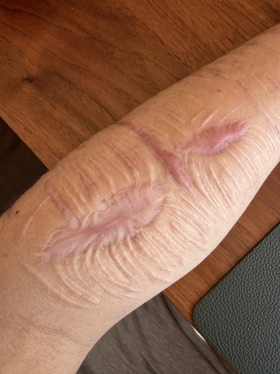 nconfused28's tweet photo. this scar really is fucking wide https://t.co/VyBS1ncxqF