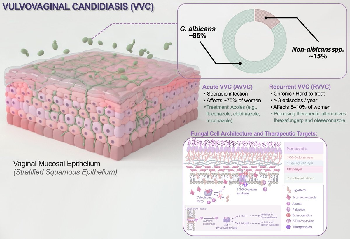 JoF_MDPI's tweet photo. What are the current and emerging therapeutic options for vulvovaginal #candidiasis?

A new review provides an up-to-date overview of therapeutic strategies for vulvovaginal candidiasis, including acute, recurrent, and difficult-to-treat infections.

https://t.co/JGsy9D8v6X https://t.co/VQRq06GMV0