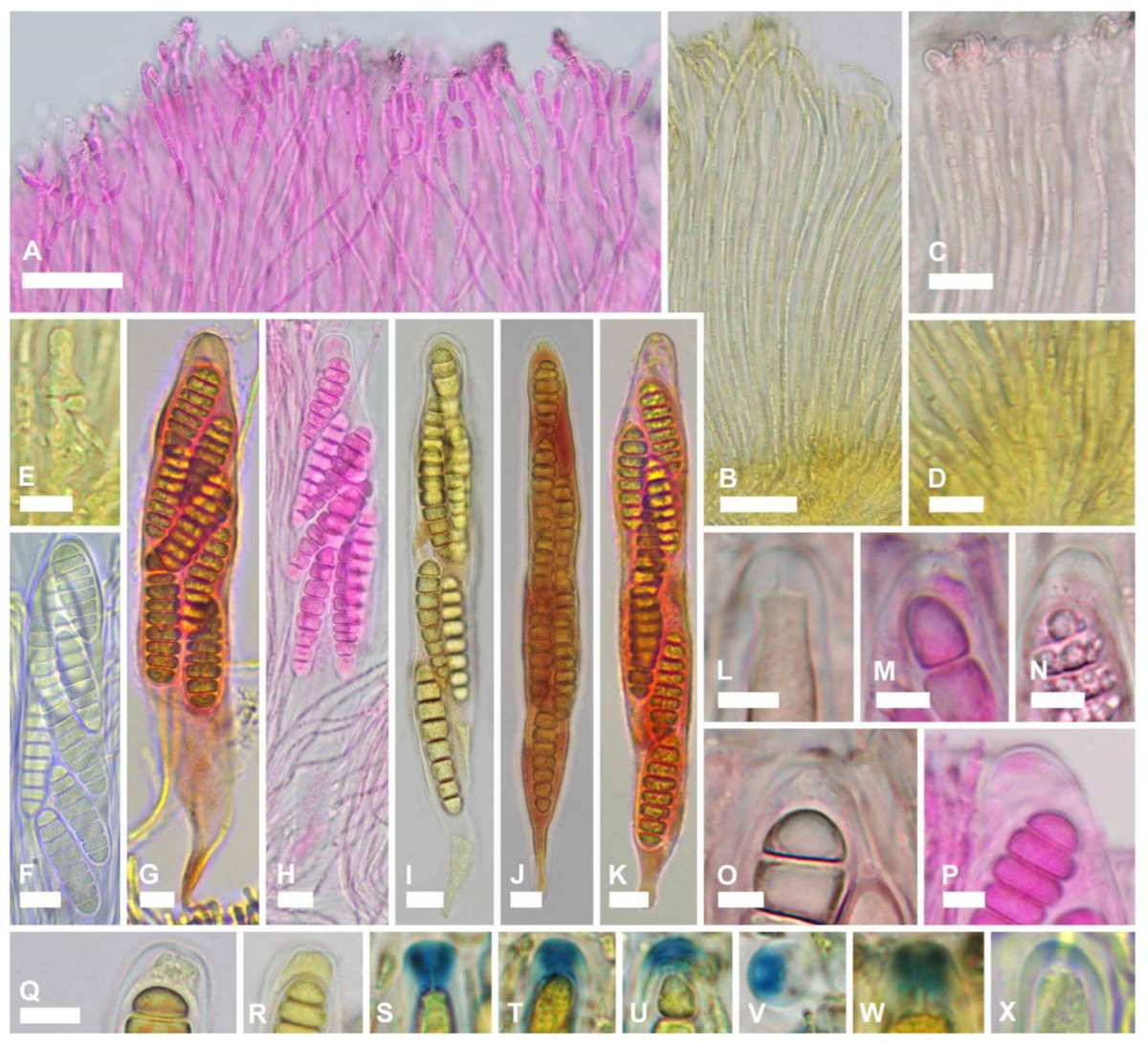JoF_MDPI's tweet photo. 🍄 A new species of Ramomarthamyces has been described!

A new study introduces Ramomarthamyces octomerus sp. nov., based on specimens collected from Mediterranean climate regions of Portugal, the Canary Islands, and Croatia.

📖 Read more:
https://t.co/mcA85cb2Po

#Mycology #JoF https://t.co/4GXETdWy2O
