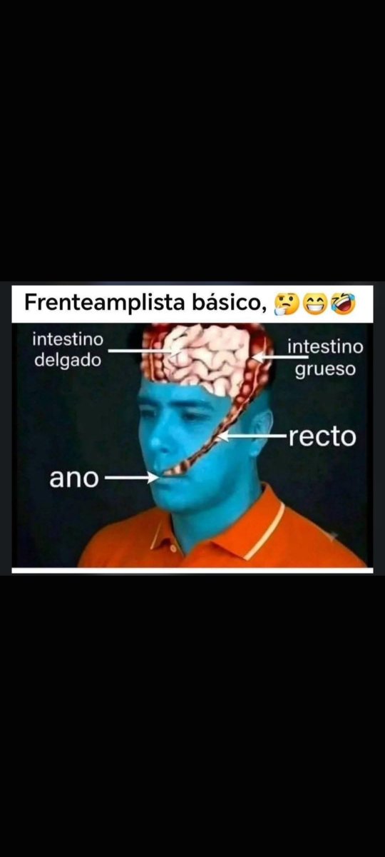 nasotocr's tweet photo. @jp_salas Usted. https://t.co/nVgVUPqcte