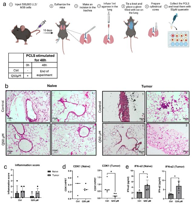 cddpress's tweet photo. “Immunoregulatory role of quercetin in lung cancer”

Quercetin exerts potent #Antioxidant, #AntiProliferative, and #Immunomodulatory effects ⤵️
https://t.co/YZXmyE5VgZ https://t.co/cE7ISI4ROV