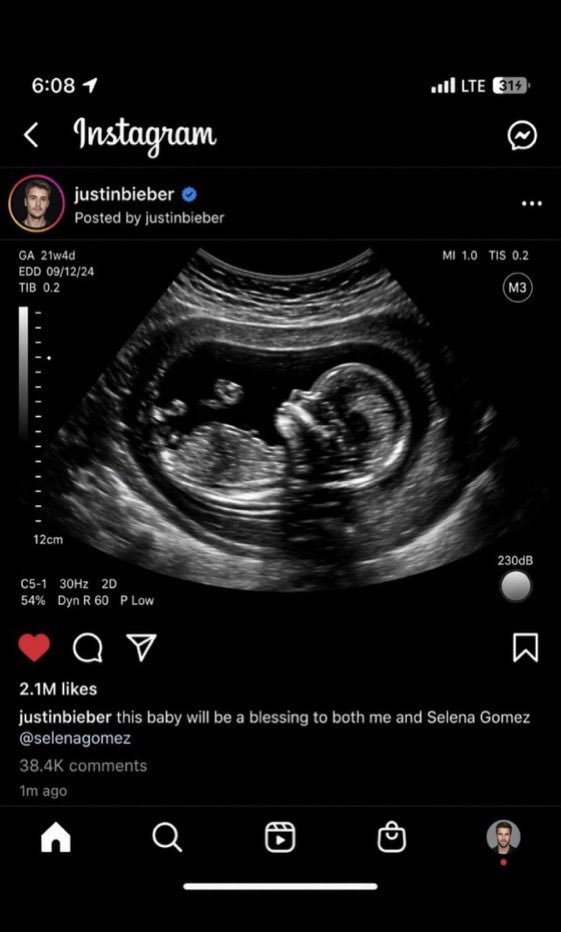 _Eniola0's tweet photo. Justin Bieber has sent fans into a frenzy after sharing an ultrasound image shortly after Selena Gomez went live on Instagram. 😳

“This baby will be a blessing to both Selena Gomez and me,” he reportedly wrote while tagging Selena.

Did Justin just confirm that he and Selena are expecting a baby together? 👀💔 Fans are absolutely stunned. 😭