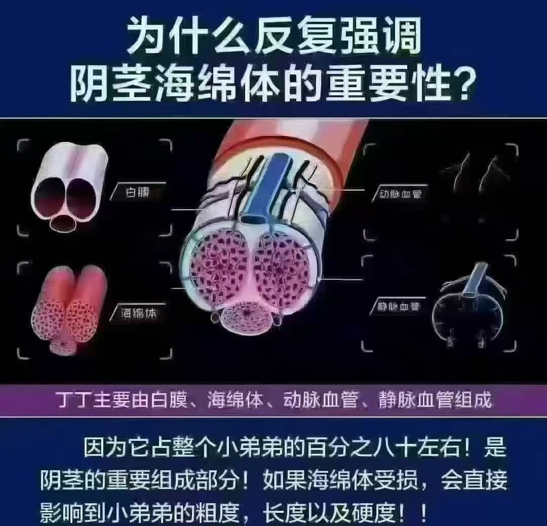 3opoa47's tweet photo. 海绵体相当于房子的钢筋，如果钢筋软了、断了，房子肯定不坚固，海绵体出了状况，硬杜肯定也会跟着出问题！ 
#东莞抓龙筋 
#东莞个人 
#东莞资源 
#东莞SPA 
#东莞个人工作室
#东莞抓龙筋
#东莞樟木头
#樟木头个人工作室 
#个人工作室 https://t.co/Aj4ycNf2bO