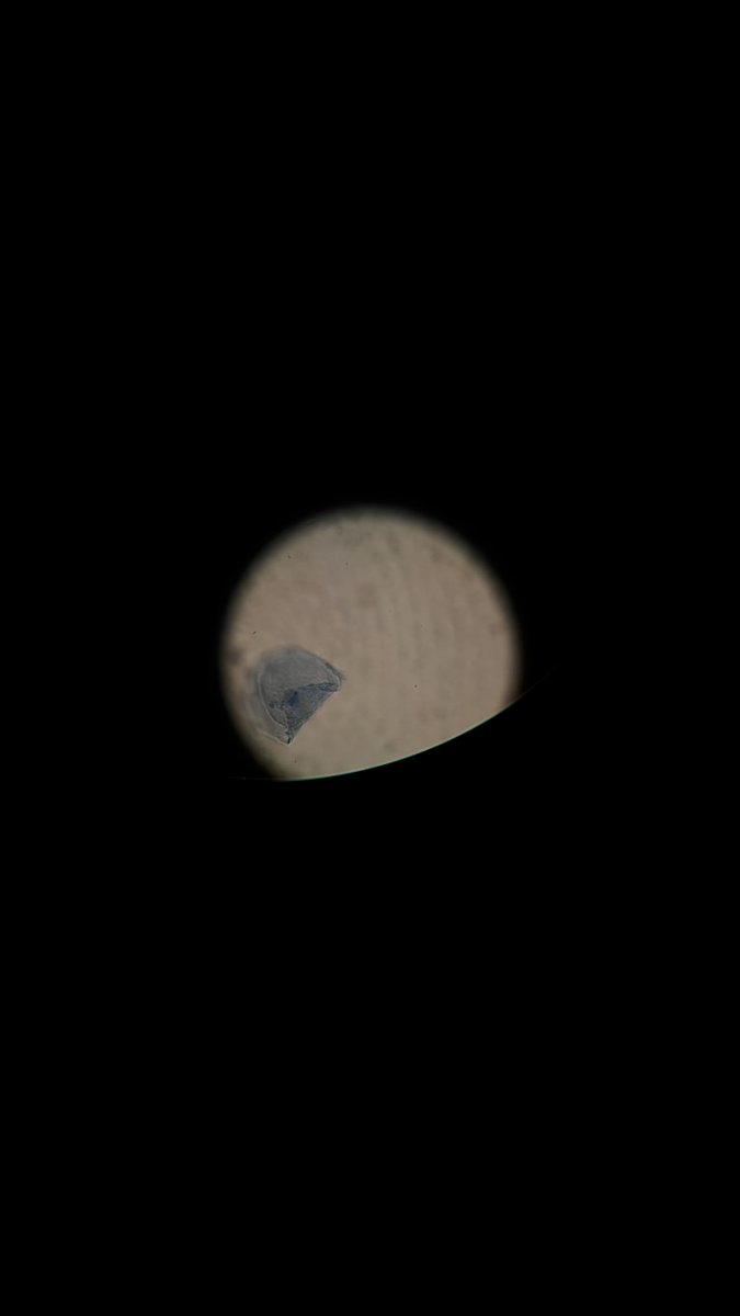 svliln's tweet photo. Lap bio 🧫
توقعو ايش الخلايا الي مصورتها؟ https://t.co/4in0Keo8mr