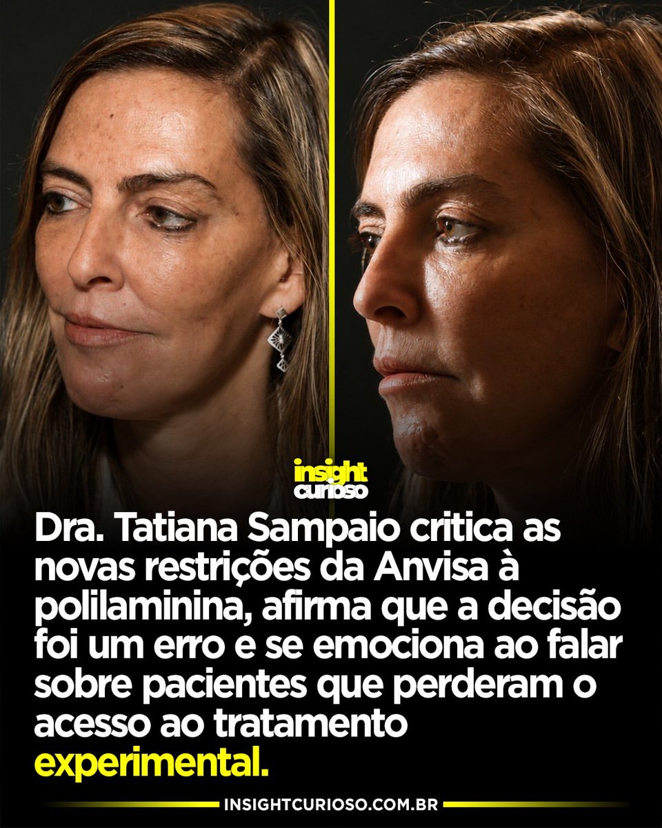 MachadoDarlon's tweet photo. 🚨🆘️🇧🇷🩺👩‍⚕️ De 90 dias, o prazo caiu para 72 horas depois do trauma, e só vale para lesão completa na coluna torácica, a parte na altura do peito. Ela chamou isso de "crueldade", numa live em 27 de agosto. Para a pesquisadora da UFRJ, a Anvisa errou ao pegar os critérios feitos para o estudo clínico e aplicar no uso compassivo, a via que libera um tratamento experimental para quem não tem outra alternativa. A substância ainda não tem registro, e mais de 100 pessoas já receberam por essa via. Da fila de uns 500, 200 já perderam o prazo com a regra nova, segundo o coordenador do programa. O primeiro estudo clínico oficial começa a recrutar em 24 de setembro, em São Paulo, com as mesmas regras de agora. São cinco vagas. 😡😢

Fonte: G1, O Globo