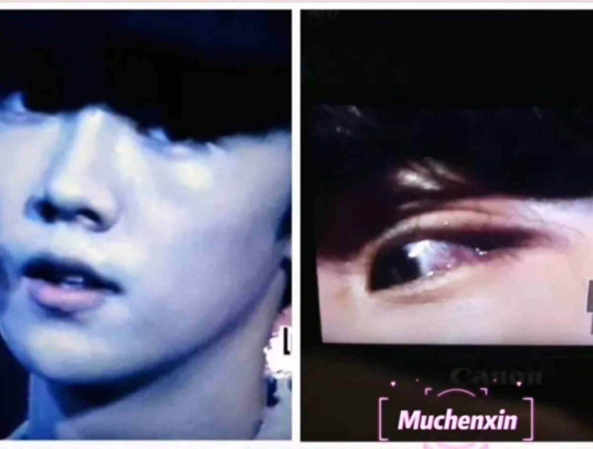 xiaollu777's tweet photo. + do you realize that the conjunctivitis in his left eye left lasting effects and complications at the time, to the point that even now, that eye still can’t tear normally! ... and some of the lasting effects of those injuries and health issues are still with him to this day :"( https://t.co/qS7xJSFUia