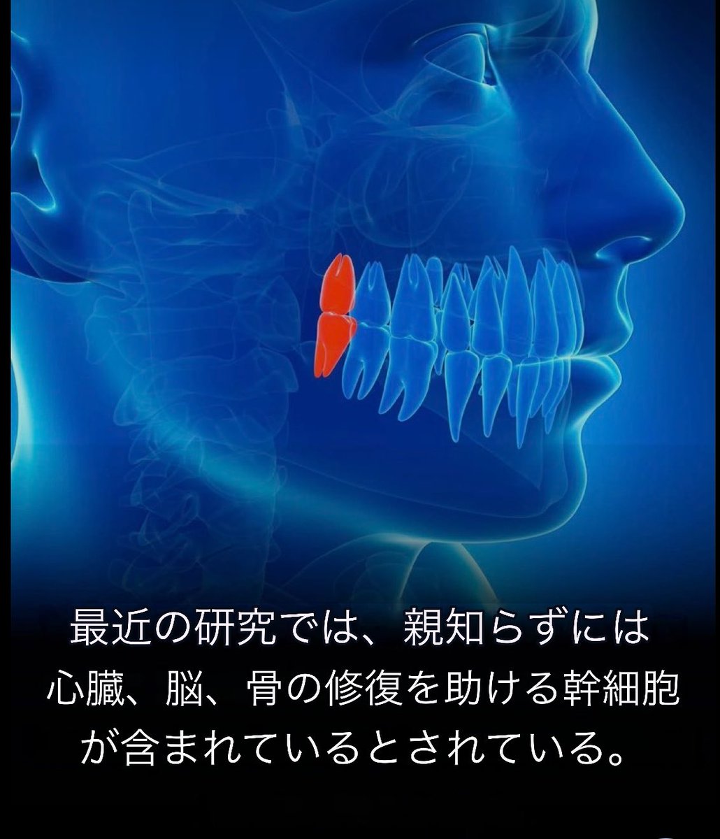 macaronmacaro15's tweet photo. 🦷親知らずには「歯髄幹細胞」が存在👇😋✨

🌱 骨の再生を助ける研究
🧠 神経を守る・再生を助ける研究
❤️ 心臓の修復を支える研究
🔬 まだ主に実験・前臨床段階
💡将来の再生医療への可能性に注目！ https://t.co/5Zth734g6n