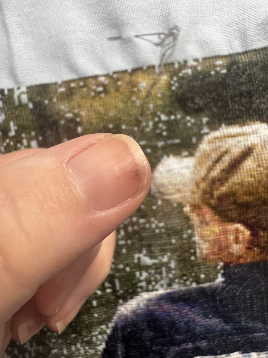 Akamamom's tweet photo. Why yes. I have indeed shoved the needle under my thumbnail a few times during this process. I’ve also worn a bit of a hole into my “catching” finger. I can’t stand thimbles, so I just deal with the *ouch*. That’s just how I roll. 🤷‍♀️ #StitchGate #SaveStargate https://t.co/KSWbCukM7G