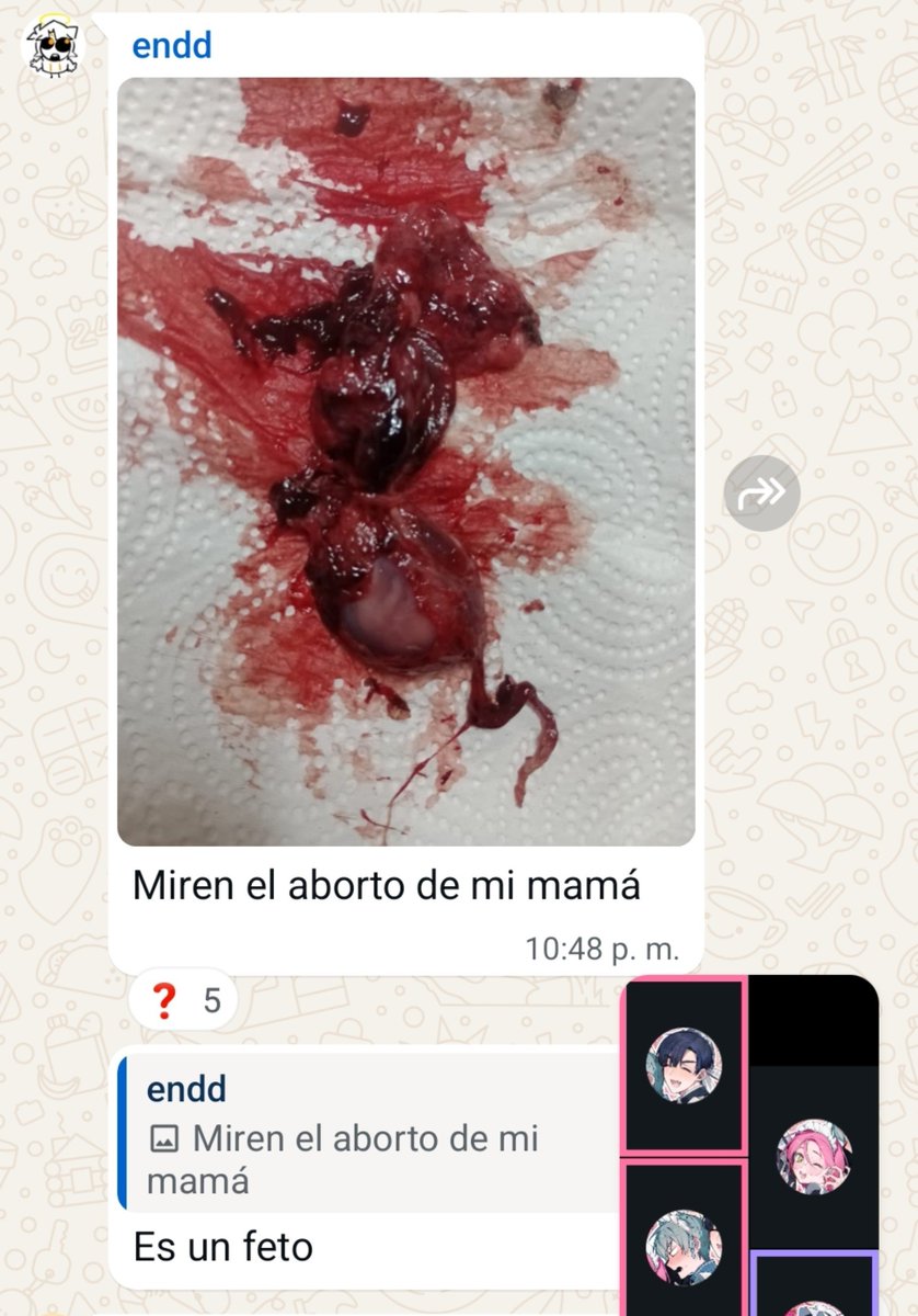 zikufilico's tweet photo. Miren el aborto de mi mamá https://t.co/Tk2CZ44qze