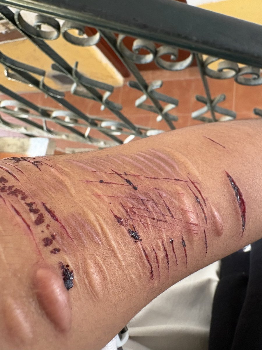 sillysaylo's tweet photo. NO TUVE TIEMPO DE HACER ALGO PROFUNDO NI DE TOMAR FOTO estoy harto de todo ybencima me lo vieron:(
#slittwt #fakemakeup #sfx
WORKING ON SFX MAKEUP EFFECTSS NOT REAL ALL FAKE ALL MAKEUP https://t.co/U1jA6n0Gaz