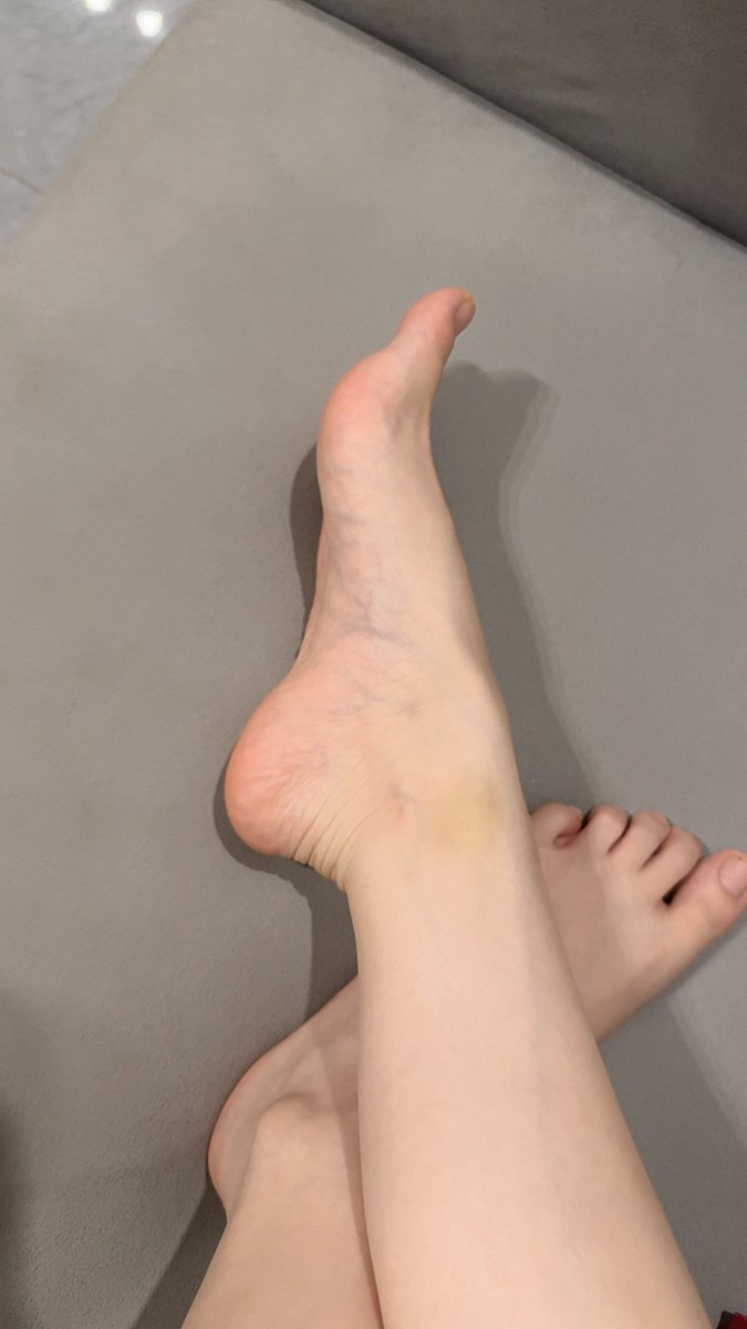 SilvaMaury32's tweet photo. 我他妈的不是说了吗？头像不是我的脚不是 我真他妈操了 ，给狗开视频狗都说怎么和头像的脚不一样，我他妈的没说吗，这他妈是最后一遍再鸡巴犯贱的，我他妈的就剁你狗鸡巴 https://t.co/GaaZ8eQ24P