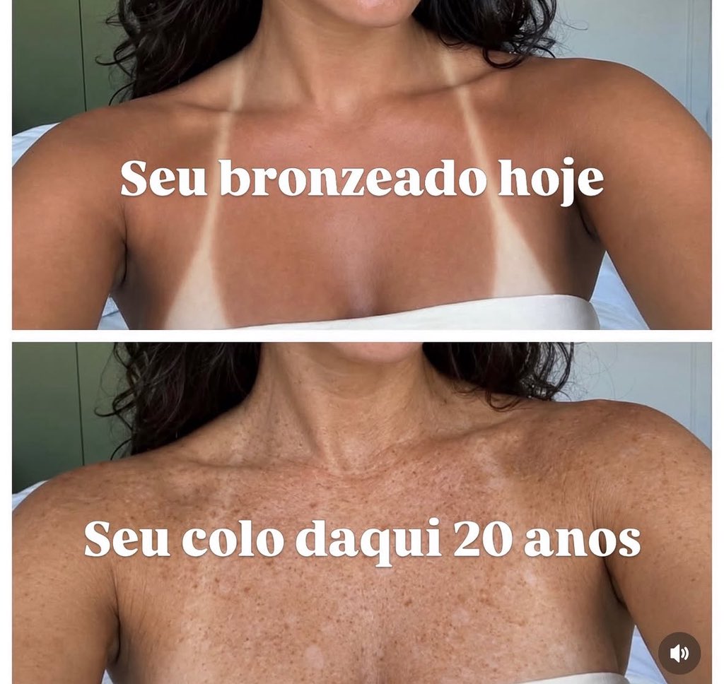 RooFrann's tweet photo. Quer envelhecer mais rápido? 

Bronzeamento está associado à exposição à radiação UV, que causa fotoenvelhecimento, manchas, dano ao DNA e aumenta o risco de câncer de pele, incluindo melanoma.. https://t.co/t1MkPOJWv1