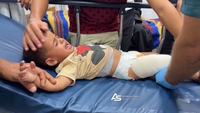 EyeonPalestine's tweet photo. Arrival of the child Ibrahim Zanoun, one year old, after being injured by a gunshot to his leg as a result of gunfire by the occupation forces stationed in the southern areas of Khan Younis governorate. https://t.co/AK9EXysWOo
