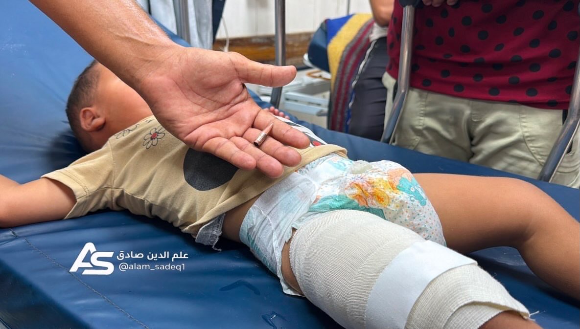 EyeonPalestine's tweet photo. Arrival of the child Ibrahim Zanoun, one year old, after being injured by a gunshot to his leg as a result of gunfire by the occupation forces stationed in the southern areas of Khan Younis governorate. https://t.co/AK9EXysWOo