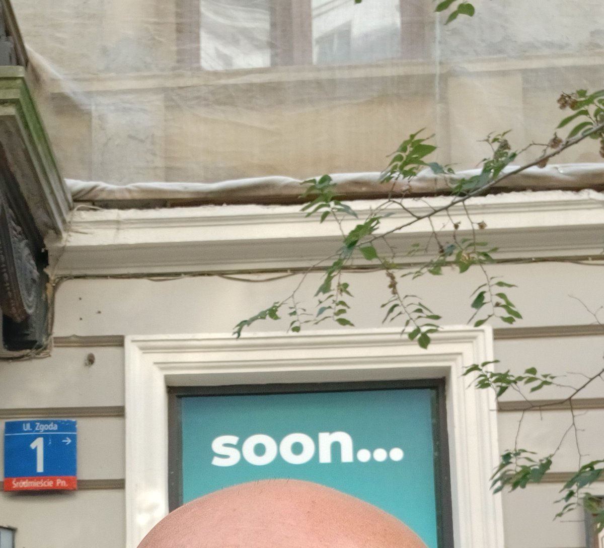Scalpies's tweet photo. Soon.... Hair than later. #Scalpie https://t.co/cnWqQt7say