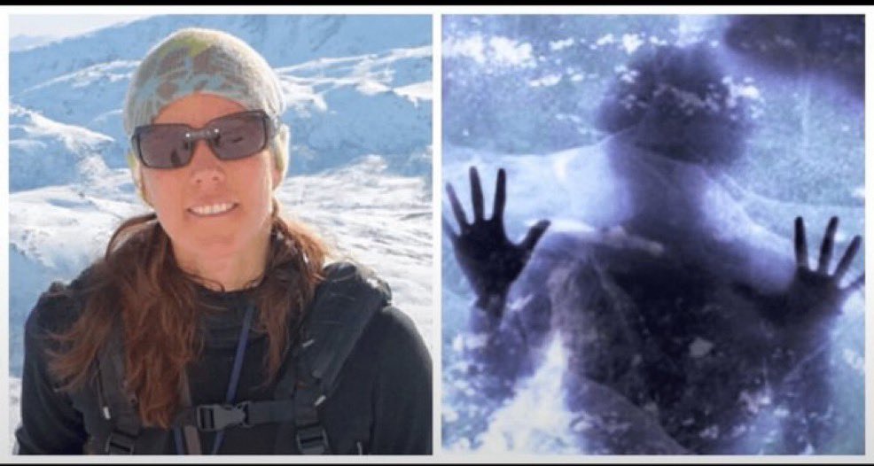 Visionaryvoid's tweet photo. In 1999, Anna Bagelholm was skiing in Sweden when she accidentally fell into a frozen river. She was stuck in the ice for over 80 minutes as rescuers struggled to free her. When they finally pulled her from the freezing cold water she was given CPR, and she was defibrillated, but the rescue team were sure she was dead.

It took two hours to get her to the hospital, by which point her body temperature was 56 degrees Fahrenheit. At the hospital she was connected to an EKG, which showed no signs of life, so doctors declared her clinically dead.

The doctors didn’t want to give up on her, so more than 100 medical staff worked in 9-hour shifts to try and revive her. Miraculously, they were able to warm up her blood and achieve a heartbeat. They then put her on a ventilator for the next 35 days.

Anna eventually woke from the coma but was paralysed from the neck down. She was angry with her friends at first for saving her life, but somehow managed to make a full recovery and now works as a radiologist.