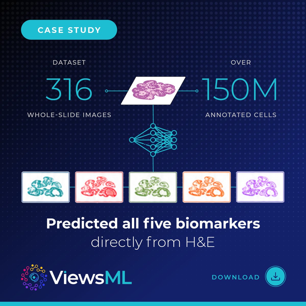 viewsML's tweet photo. ViewsML enables researchers to characterize the tumor microenvironment at single-cell resolution, at a scale that conventional multiplex assays can’t achieve. 

Learn more: https://t.co/zQ4tLewhZl https://t.co/4Q1Eotrn6G