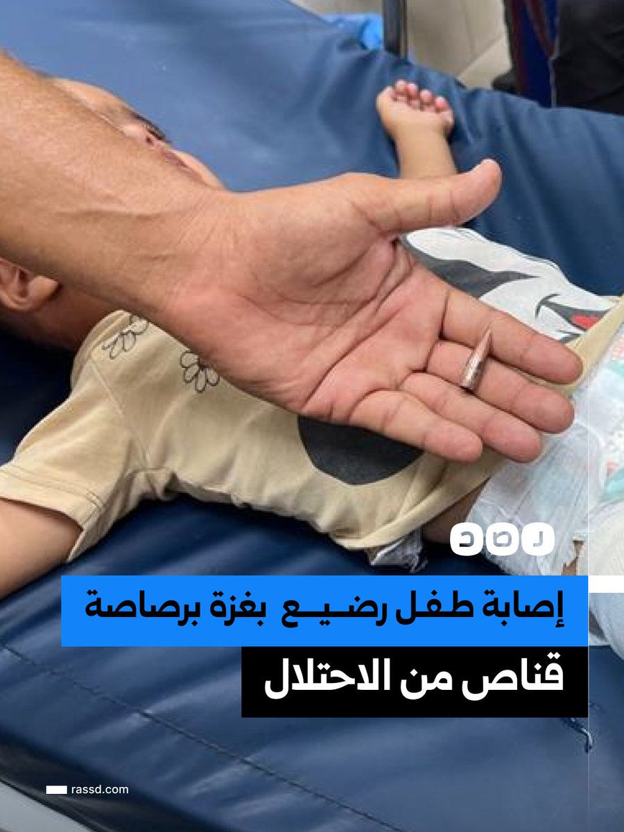 RassdNewsN's tweet photo. إصابة طفل رضيع في غزة يدعى إبراهيم زنون في رجله برصاصة قناص من الاحتلال https://t.co/JnJreEuyDG