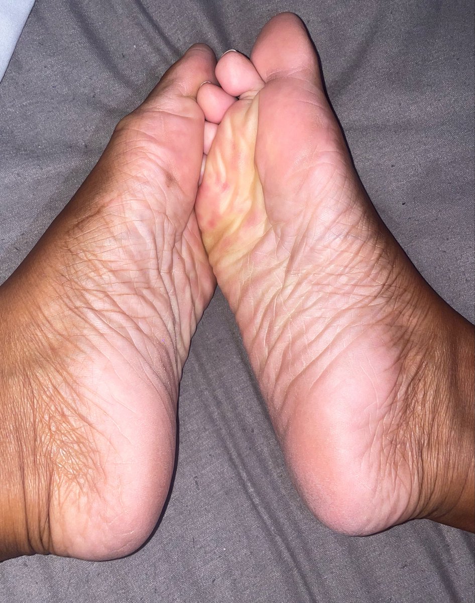 GodessBeautS's tweet photo. Dry soles or oily soles? 

#Findom #FeetFindom #FootFetish #FinancialDomination #PayPig #Tribute #FootWorship #Soles #SendCoffee #FindomFeet #Drain #Pedicure https://t.co/LBiqp3J0m7