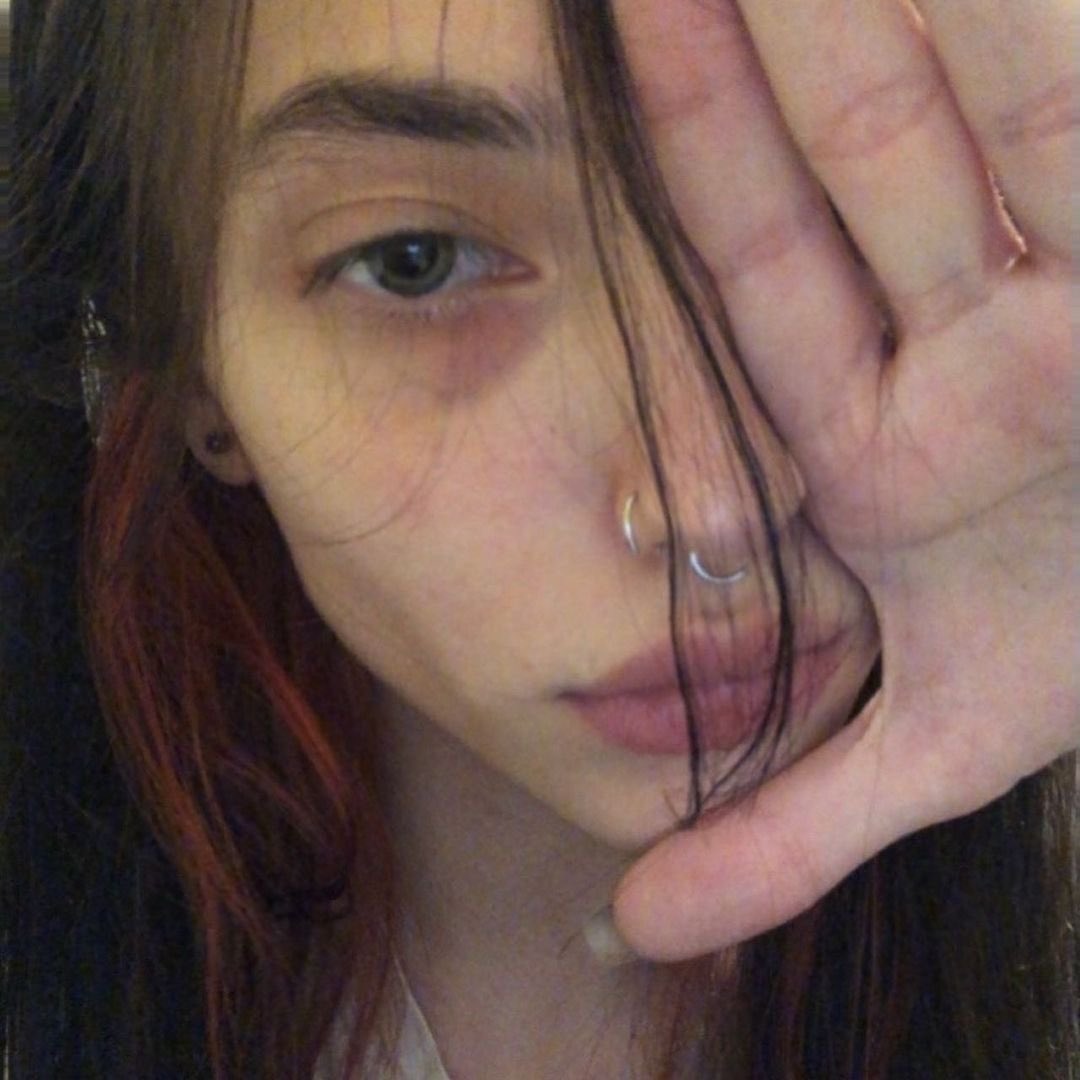 plsdrunktextme's tweet photo. I need hollow cheeks so freaking bad https://t.co/thteBybQkI