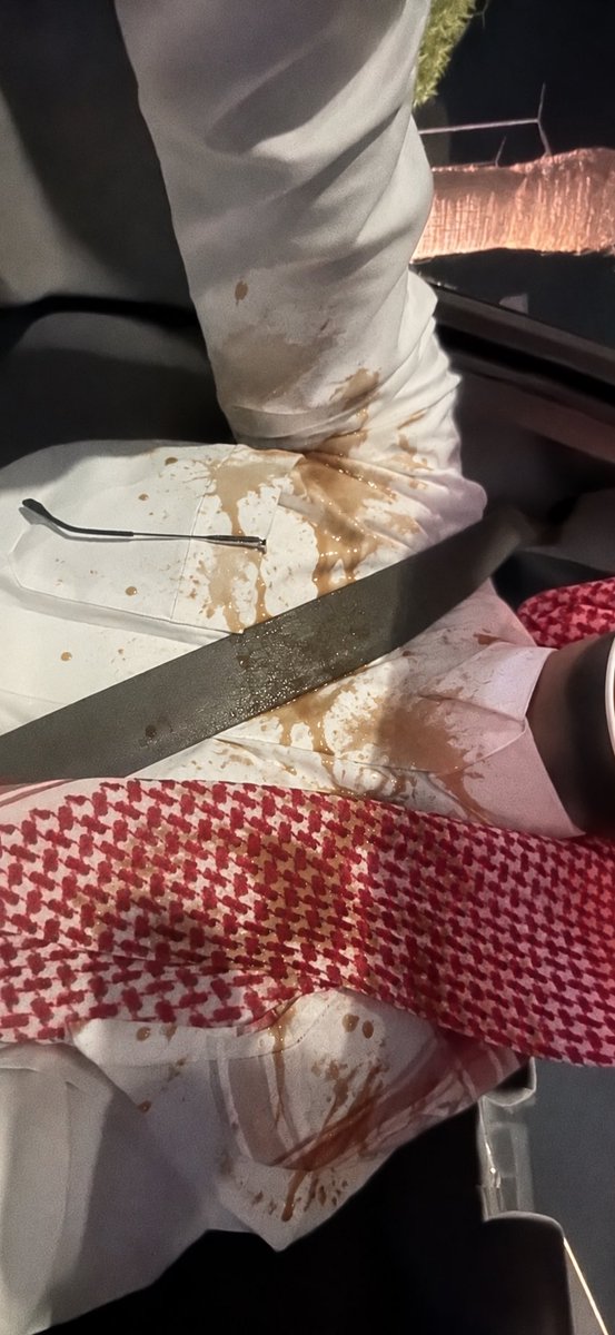 iimhmw's tweet photo. الله يلعن ابوك علشان قلت عطيني سنابك تكبين علي القهوه الله لايوفقك https://t.co/b8Q1od7BFk