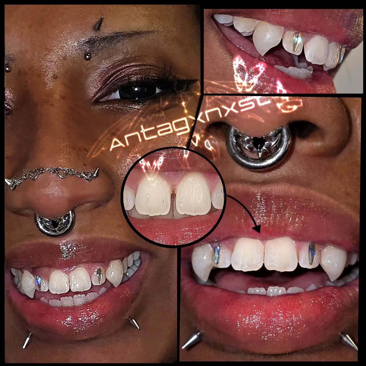 antagxnxst's tweet photo. Gap fill & Chibi #permafang set for this beautiful client ✨️🦇
Texas is almost booked out, and don't miss California this October!
Booking link in bio ~
•̩̩͙*˚⁺‧. •̩̩͙*˚⁺‧.˚ *•̩̩͙ ✩. •̩̩͙*˚⁺‧. •̩̩͙*˚⁺‧. ˚
#vampire #permafangs #toothmod #bodymod antagxnxst fu… https://t.co/mTqgiS7nMh