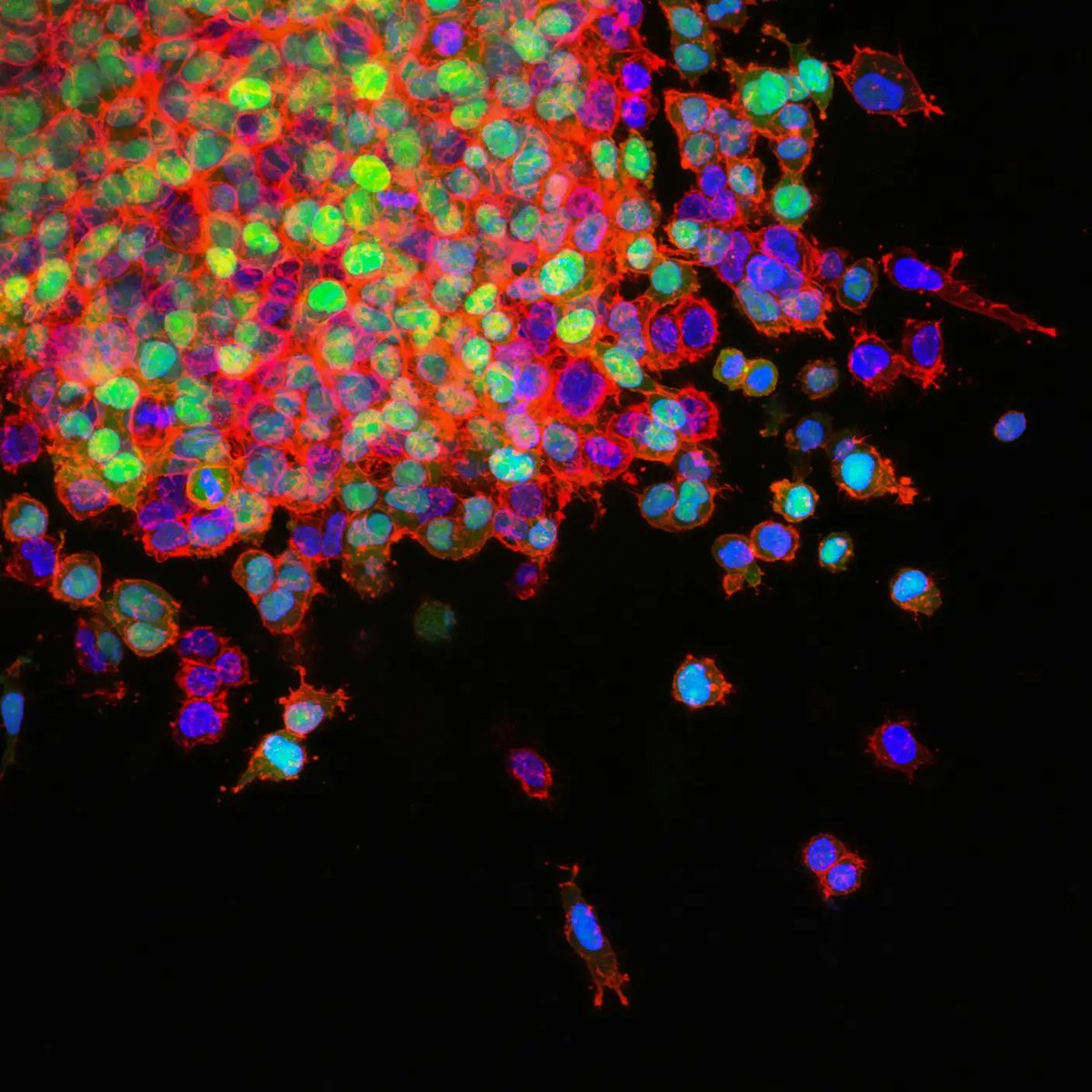 singularityhub's tweet photo. Three-Year-Old Boy’s Metastatic Cancer Disappears After Two Shots of Experimental Cell Therapy https://t.co/jZal3J39Ag https://t.co/pA0n6W4s5r