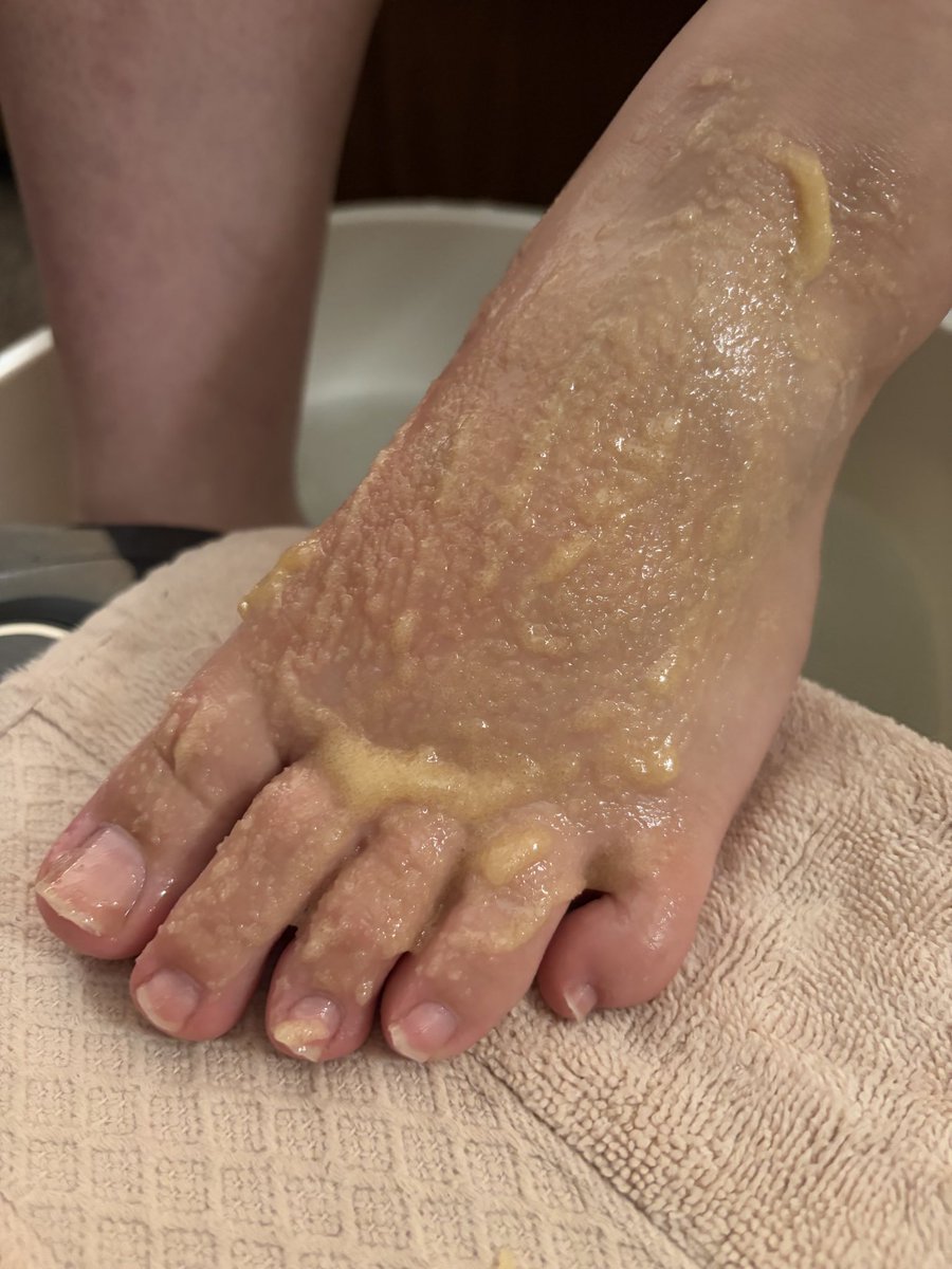 ToesTemptGirl's tweet photo. Scrubbing my stinky feet 🦶🤢

Feetfinder- ToesAndTemptationGirl

#stinkyfeet #dirtyfeet #feet #toes #feetfetısh #feetworshi̇p #feetfinder #feetpictures #feetdaddy https://t.co/njKL5E0VJD