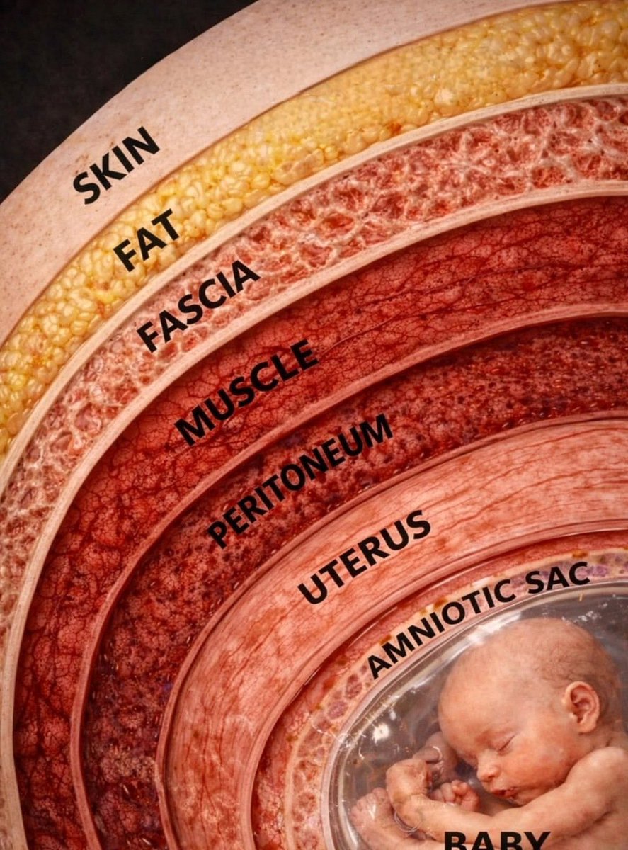 thatguytelvin's tweet photo. WHAT YOUR BODY WISHES IT COULD SAY. 📖 

I wanted to show C-section from a different perspective, not the usual baby themed cake, but what happens beneath the skin.

Every layer represents a part of the body, leading to the moment of birth.

A cake can be more than decoration. https://t.co/Fbzbnb0f2o