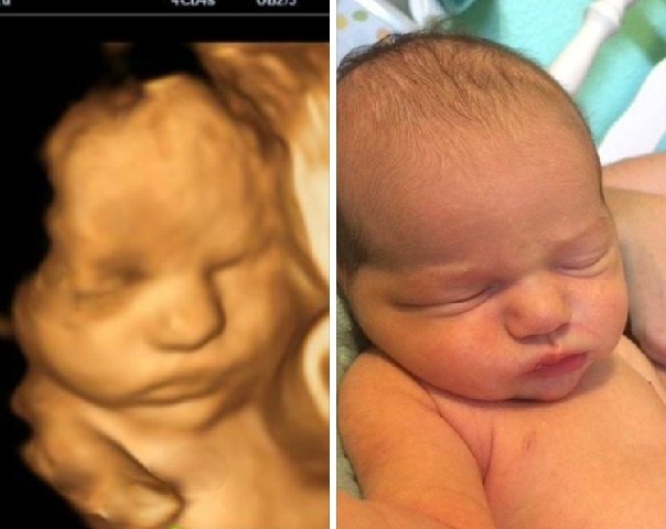 KristanHawkins's tweet photo. Location doesn’t determine worth.  

It’s a baby in the womb.

It’s a baby out of the womb. https://t.co/5EOK920hqh