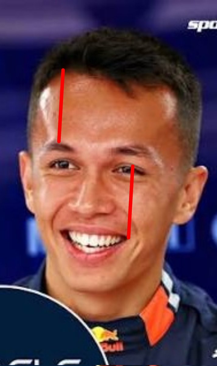 jefwun's tweet photo. Not moved a squeak since he was a kid he just has a big ass forehead ok https://t.co/6r5rmDwKPo