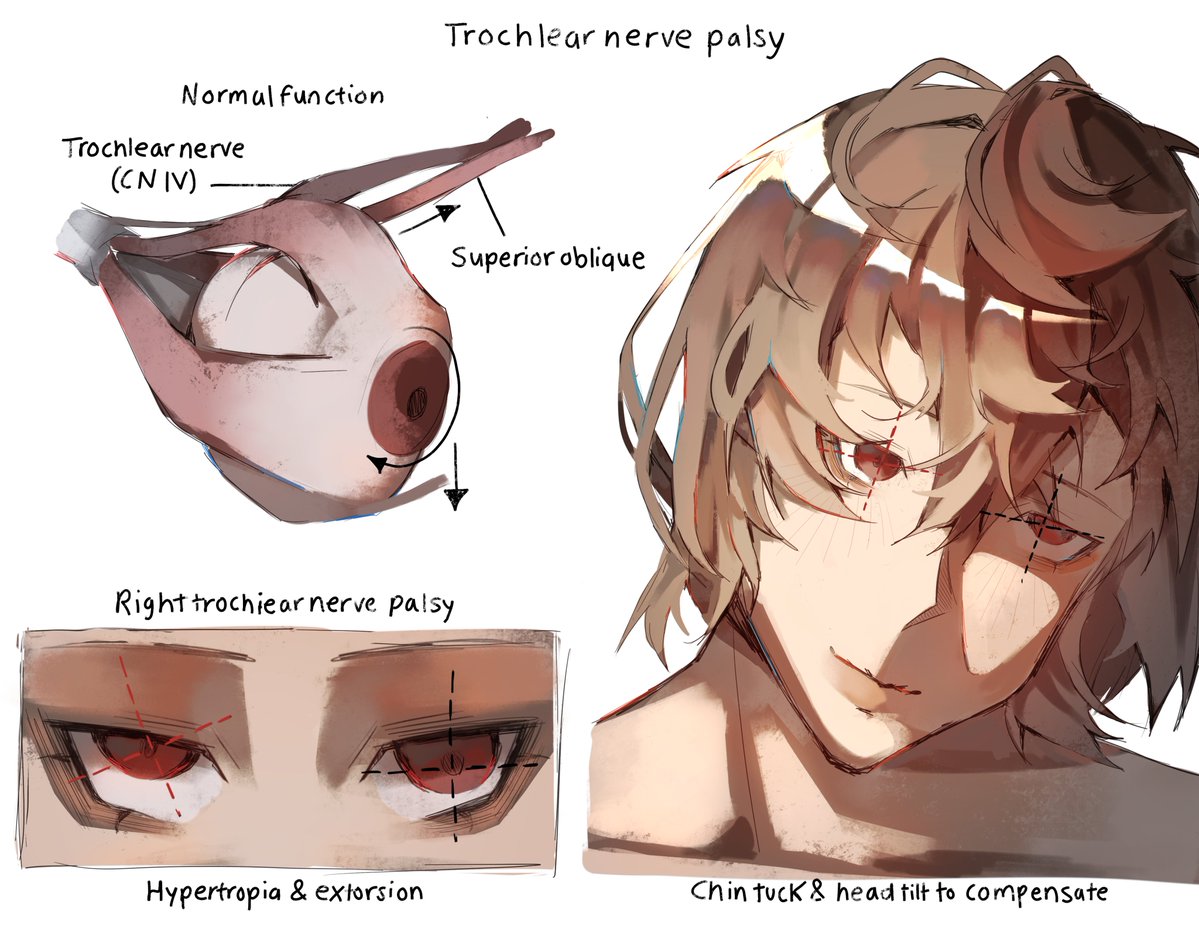 Ephermaeow's tweet photo. Trochlear Nerve Palsy × Akechi

#akechi #persona5 #fanart #digitalart #artmootsㅤ https://t.co/0eo0m47drA