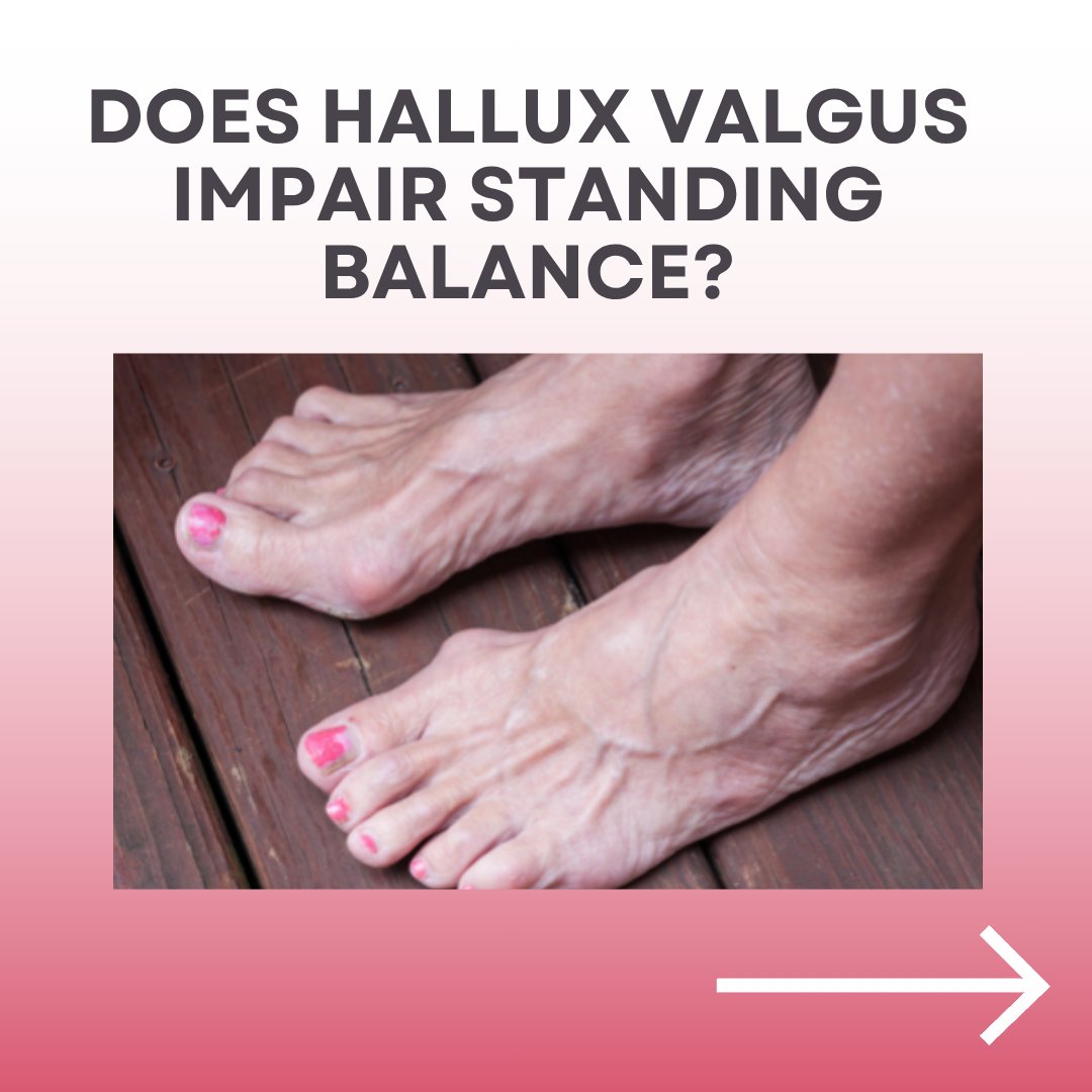 alisongrimaldi's tweet photo. Does hallux valgus impair standing balance?👣
Research suggests foot pain, mobility and muscle capacity may be more important than deformity alone. Maintaining foot muscle strength could help support balance &amp; function.
Singup to our online course formore!
https://t.co/0SXoObIagB https://t.co/DVD77cHV5R
