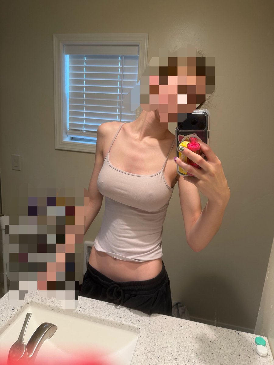 anorexbea's tweet photo. I slept 14 hrs to avoid eating https://t.co/F8r14PL1Mv