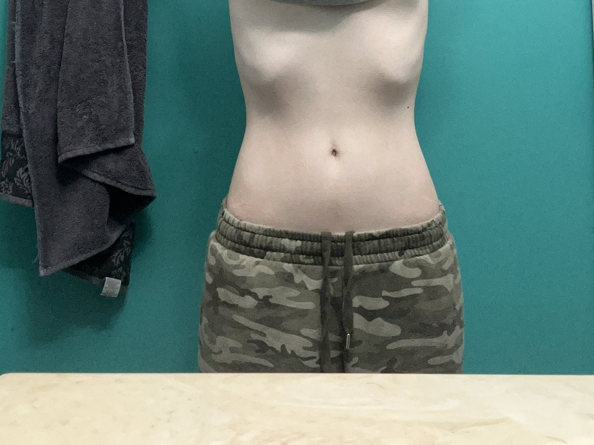 starvwinter's tweet photo. Bc
Without checking my profile, what bmi do I look?  #edrtwtㅤ #thinspo https://t.co/YdXisSDipl