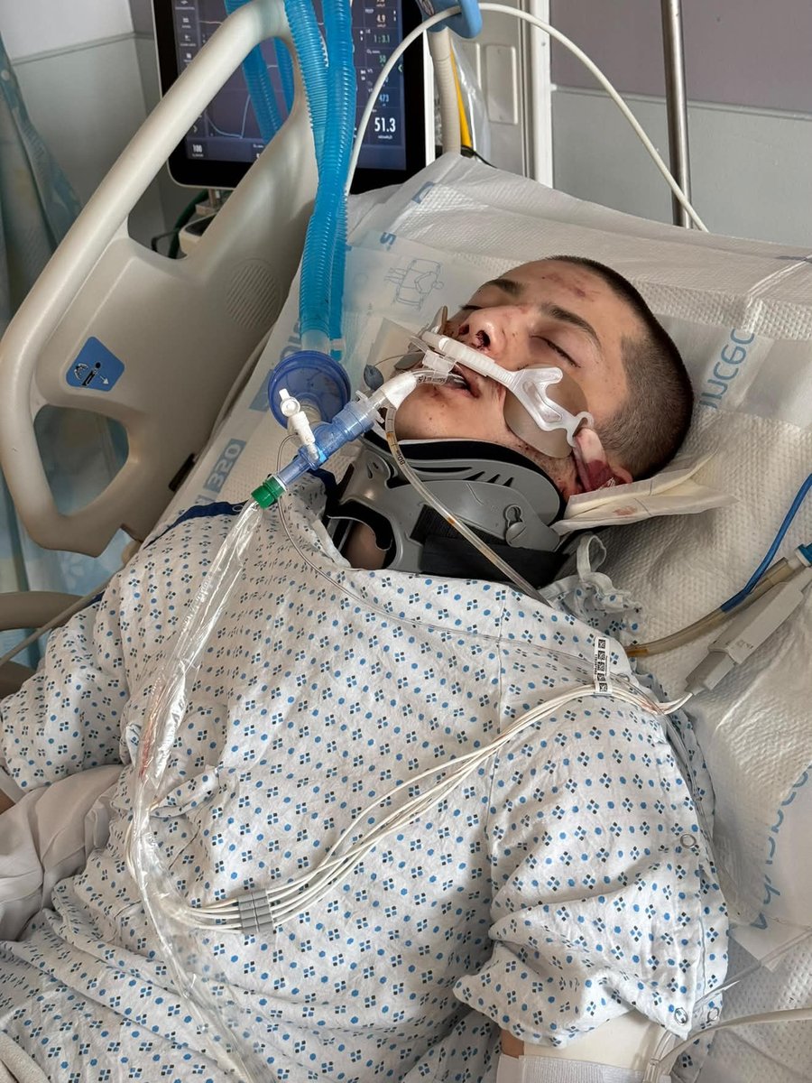 tyleraloevera's tweet photo. Remember Hatzolah? The Jewish volunteer EMS?

A follower reached out to me after his 19 year old brother was hit by an unmarked Hatzolah "emergency vehicle" smart-car speeding through Brooklyn without sirens, launching him 30 feet into the air.

Over 1 year later, after suffering a massive head injury his brother is still in a coma...

I could barely find any media coverage of this story, and I wanted to share it further.

DM me if you or anyone else you know has had any experiences similar to this with either Hatzolah (Jewish volunteer EMS), or Shomrim (Jewish volunteer 'civilian patrol squad').