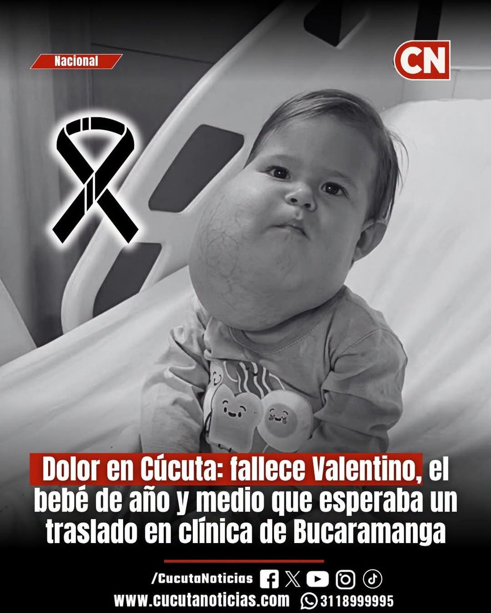 CucutaNoticias's tweet photo. #AtenciónCN ⚫🔴 El luto embarga a la ciudad de Cúcuta tras confirmarse el lamentable fallecimiento de Valentino, el pequeño de un año y medio que permanecía hospitalizado en la Clínica Foscal de Floridablanca. El menor luchaba por su vida ante una grave complicación en sus pulmones.

El niño había ingresado a la institución de salud para tratar una malformación vasolinfática en el lado derecho de su rostro. Sin embargo, durante el tratamiento su estado de salud sufrió un severo deterioro respiratorio que comprometió gravemente sus vitales funciones.

Ante la falla pulmonar, los médicos tratantes ordenaron la remisión inmediata del infante hacia el Instituto Cardiovascular de Floridablanca. En este centro de alta complejidad era indispensable realizarle una terapia ECMO para permitir oxigenar su sangre en UCI.

Su madre, Maryuri Hernández, elevó un desesperado clamor público a la Nueva EPS para lograr la rápida autorización del procedimiento. Con profunda angustia, la mujer insistía en que los pulmones de su hijo requerían descansar para lograr su pronta recuperación integral.

Pese a la imperiosa urgencia manifestada por sus familiares para concretar el traslado al centro especializado ubicado a pocos metros de la clínica, la salud del menor empeoró. Lamentablemente, Valentino no resistió la dura crisis y falleció en el centro hospitalario.

La tragedia de Valentino refleja la dura realidad que afrontan cientos de hogares en Norte de Santander, cuyos pacientes deben desplazarse hacia el departamento de Santander en búsqueda de servicios de salud de alta complejidad no disponibles o represados en Cúcuta.

Las demoras administrativas en la aprobación de remisiones por parte de las aseguradoras continúan generando indignación en la población. Diversas organizaciones sociales señalan que los trámites burocráticos no deben anteponerse a la preservación de la vida.

Hoy, Cúcuta se une en solidaridad con la familia Hernández en este amargo trance. Este triste desenlace reitera el llamado urgente a humanizar la atención médica y velar para que ningún otro niño de la región pierda la vida esperando un trámite vital.