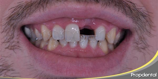 zacatrips's tweet photo. Estoy en un dilema si arreglarme los dientes o comprar el
iPhone 18 pro Max que me recomiendan ? https://t.co/EMuziEH2Qn