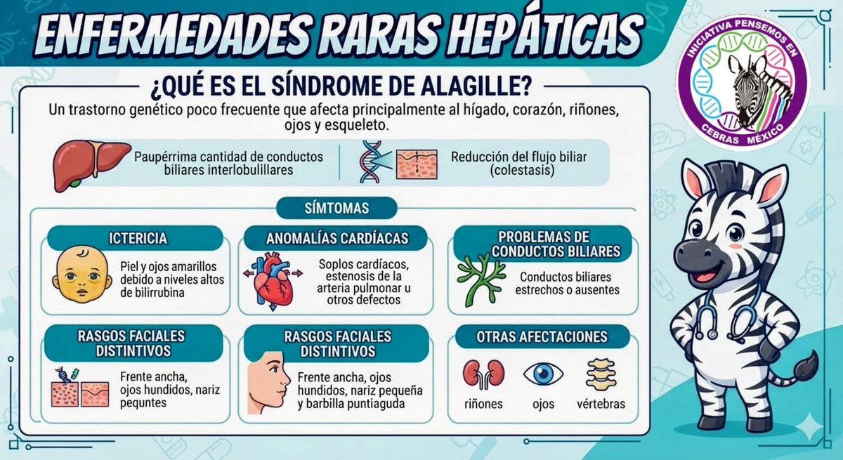 PCebras's tweet photo. Las #Enfermedades RarasHepáticas son complejas de diagnosticar, por ello es fundamental identificar sus características y principales síntomas. El Síndrome de #Alagille es una de las #EnfermedadesRaras 
Conoce más  👉 https://t.co/OGgk1WC1PI