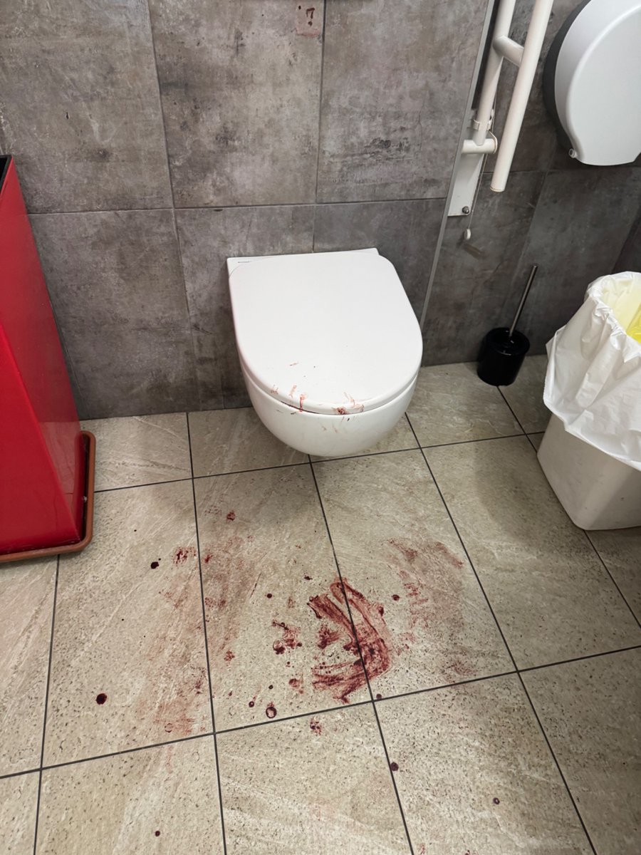 Matteo79364195's tweet photo. @Sabo82AS Questa è una foto che ho scattato stasera nel bagno del bar della mia compagna la cui si è presa una sforbiciata tra le mani mentre tentava di sedare una rissa tra musulmani. Si io li voglio mandare via perché sono TUTTI così. https://t.co/3ozlnwGOcx