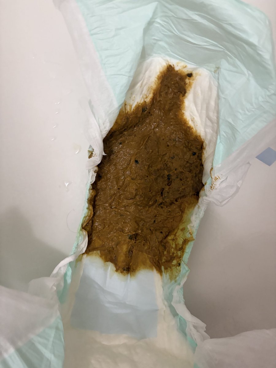 Jc18876159's tweet photo. I had to poo 💩💩 so bad I destroyed this diaper. Will post the rest of the pictures tomorrow. diaper was sagging after this load i dropped.
#gayscat #scat #pooping #shitfetish #shitpig #gayfetish #shitpig #pooping #gaypoop #gayshit #malescat #poop #coprophilia https://t.co/YbB2wLRRFw