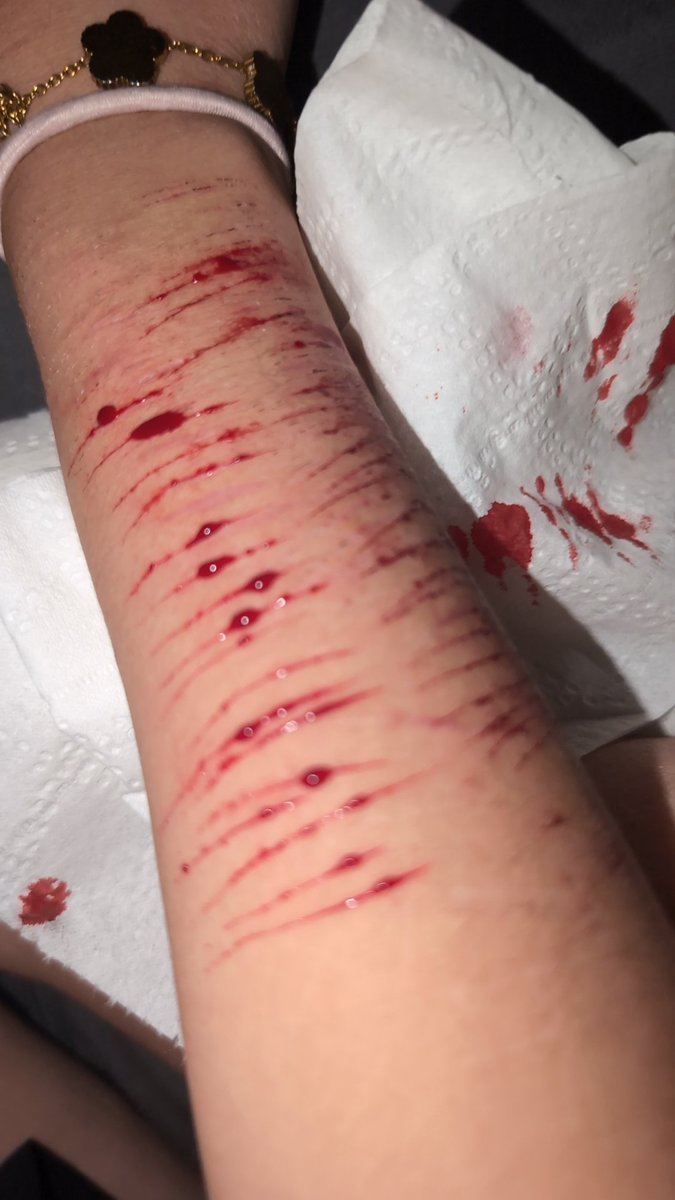 Miux134340's tweet photo. #shtwt #relapse https://t.co/FFq3An6OgB
