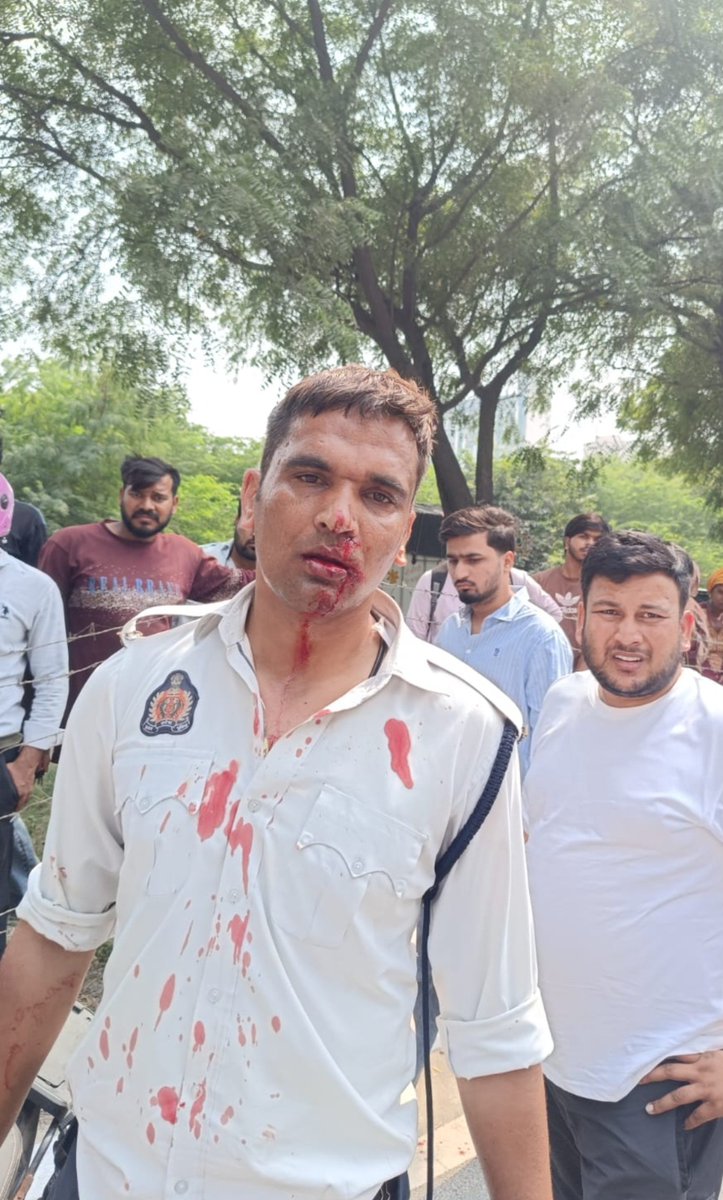 UzmaParveen94's tweet photo. नोएडा में रोंग साइड आ रही कार ने ट्रेफिक पुलिस की बाइक को मारी टक्कर , ट्रैफिक पुलिस कर्मी अस्पताल में भर्ती।

कार को एक महिला चला रही थी जो कि रोंग साइड से तेज गति से आ रही थी।

इसलिए ट्रैफिक नियम Follow करना चाहिए क्योंकि आपकी एक गलती आपके लिए और दूसरों के लिए खतरा बन सकती हैं।

जीवन बहुत अनमोल है ,आपका भी और दूसरों का भी , इसलिए हमेशा ट्रैफिक नियमों का। पालन करते रहे।