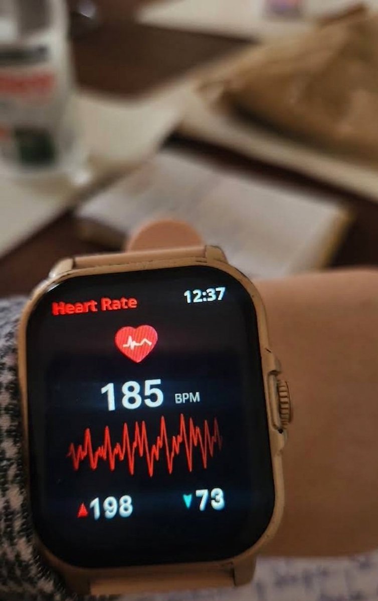 Marigq03's tweet photo. @mi14gr0s3 Presión arterial ¿Quien te conoce? https://t.co/P8QcMXp6GV