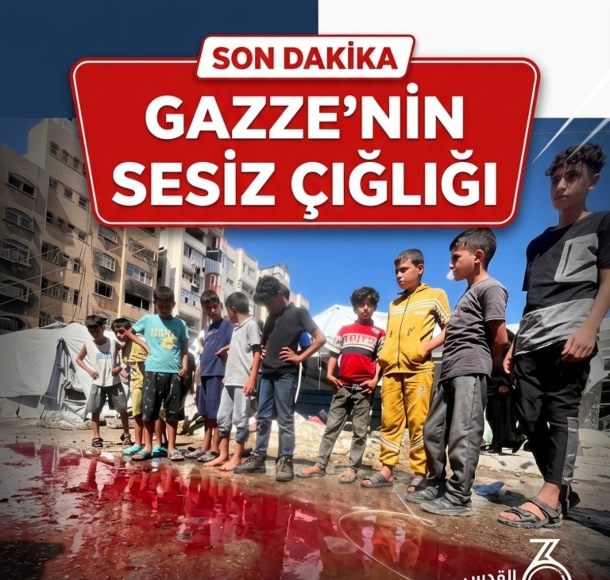 Ferdi_Karabasan's tweet photo. Gazze kan gölü https://t.co/yNUN7MmQnG